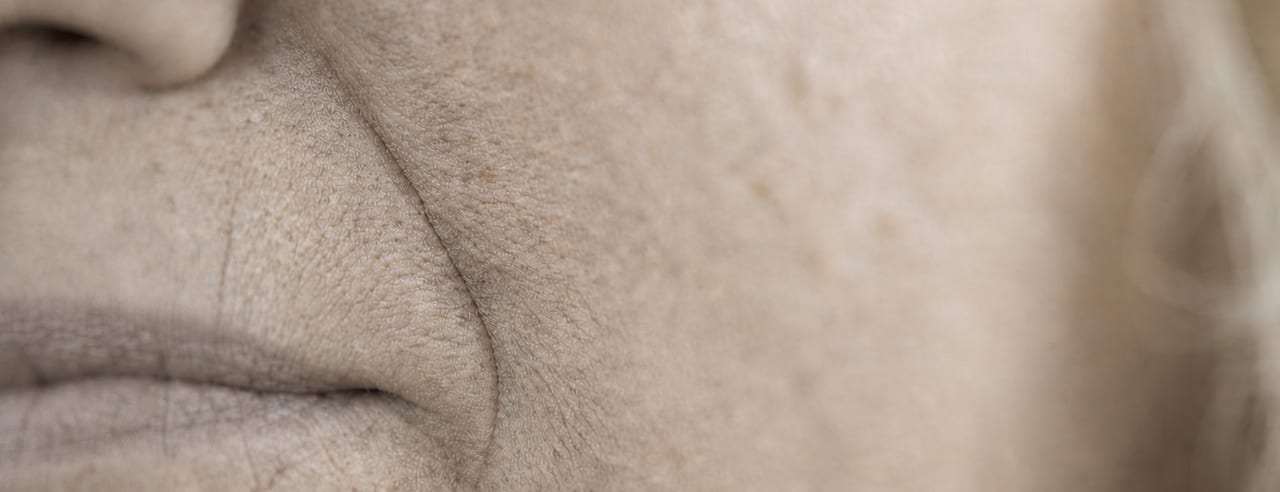 Macro du sillon nasogénien et de la commissure des lèvres au repos, relief du pli modelé par une lumière rasante.