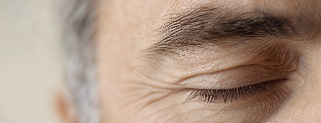 Paupière supérieure baissée d'un homme aux sourcils fournis, pli palpébral et rides périorbitaires creusés par une lumière rasante.