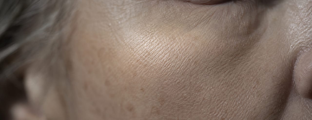 Tiers moyen d'un visage de trois quarts : galbe malaire pris en écharpe par une lumière haute, sillon nasogénien fondu dans la pénombre.