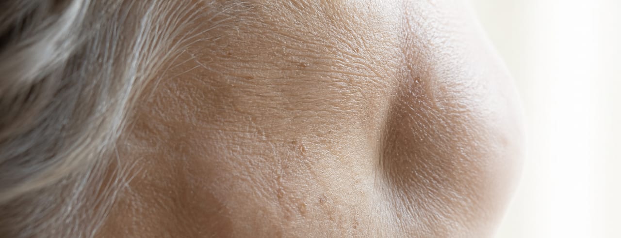 Tempe et creux de la joue d'une femme âgée, peau fine dont le duvet devient visible dans un contre-jour latéral arrière.