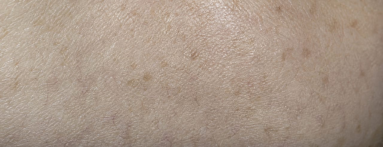 Macro d'une joue traitée comme une topographie : pores dilatés, petites taches pigmentaires et micro-relief en lumière rasante.
